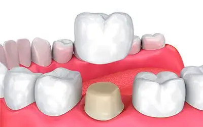 cancun dentist