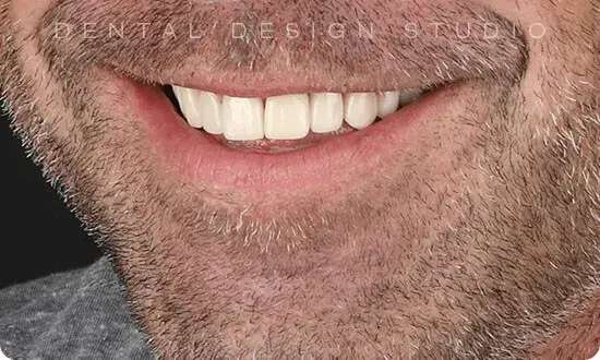 dentista en cancun