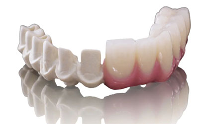 cancun all on 4 dental implants