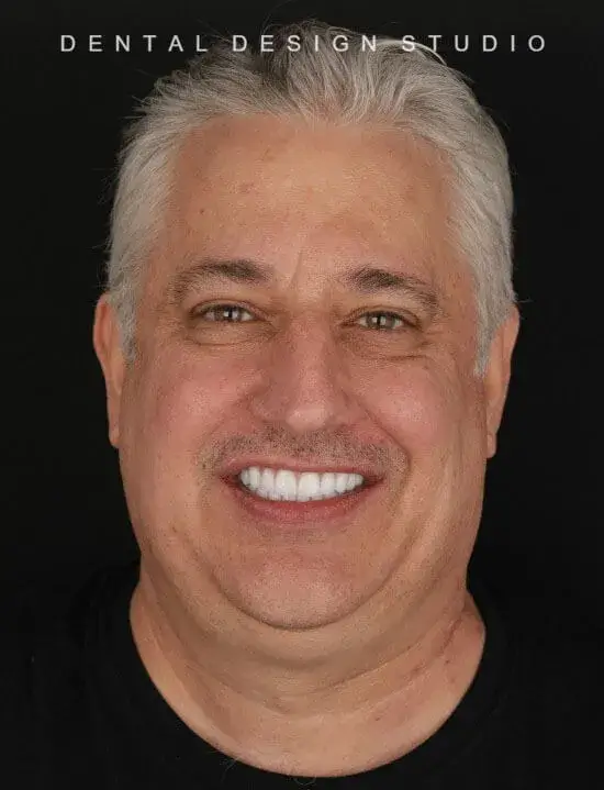 Best dentist in cancun