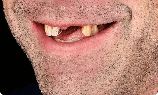 Best dentist in cancun
