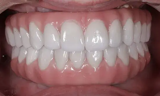 Best dentist in cancun