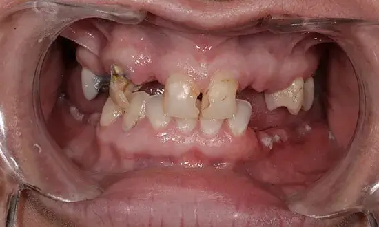 Best dentist in cancun