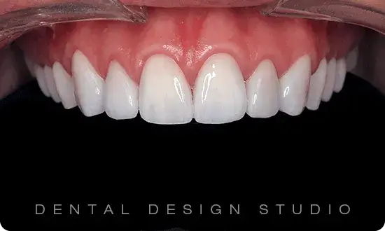 Best dentist in cancun