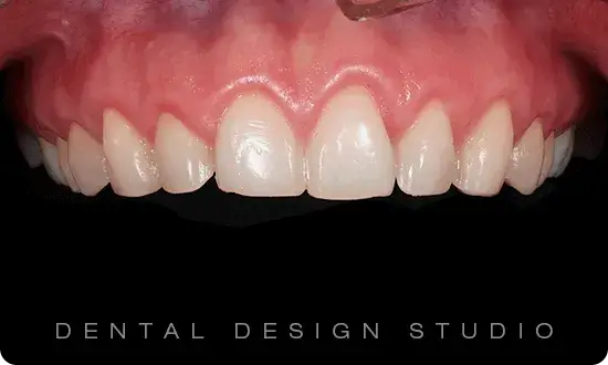 Best dentist in cancun