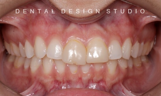 cancun cosmetic dentistry